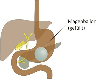 Magenballon3